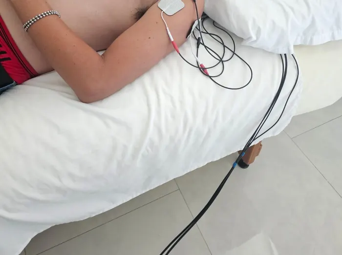 Electrodos de electroterapia colocados en el hombro de un paciente